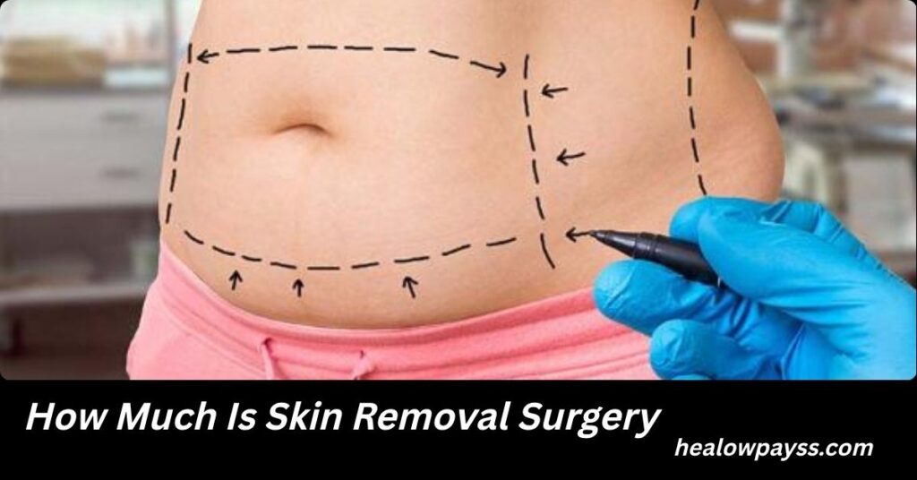 How Much Is Skin Removal Surgery