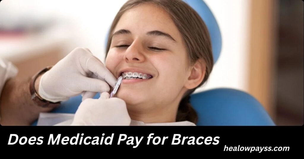 Does Medicaid Pay for Braces